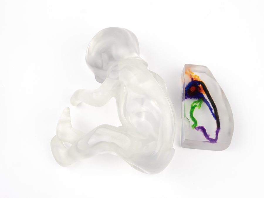 Fetal 4D Flow Voxel 3D Printed Model from MRI