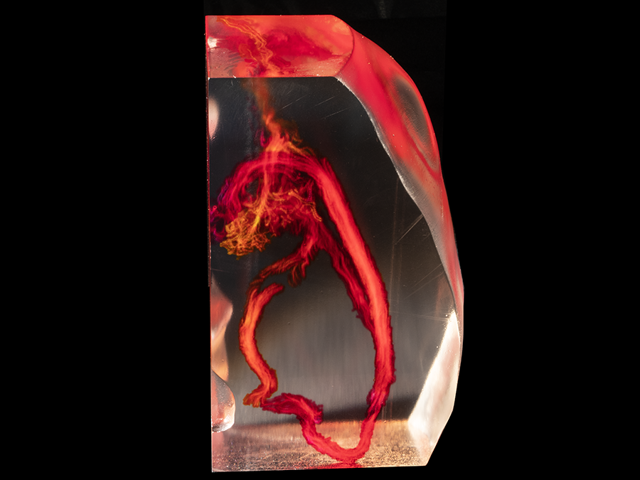 Fetal 4D Flow Voxel 3D Printed Model from MRI