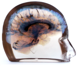 Cross-section of a human eye, showing the iris, pupil, and surrounding structures.