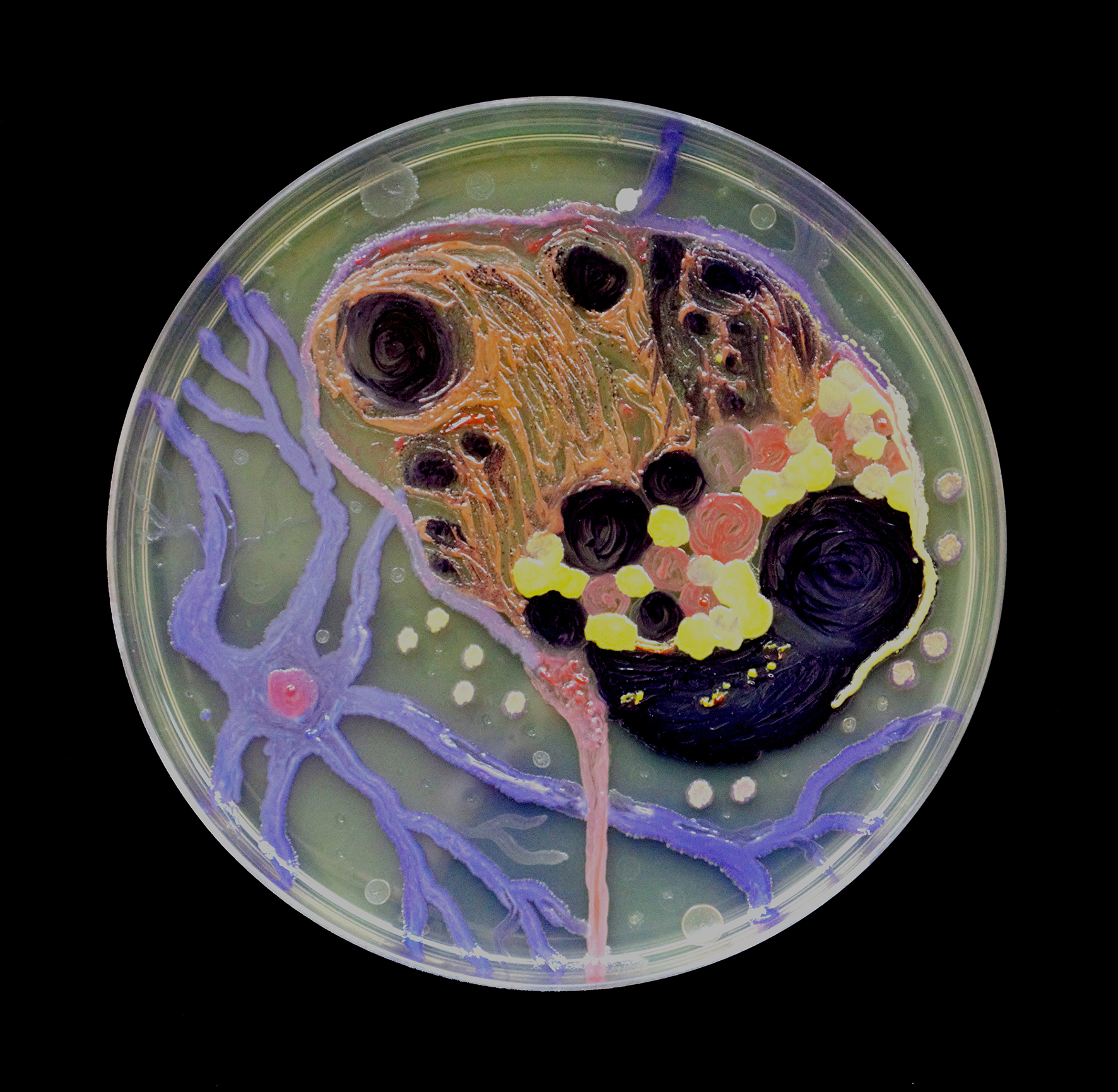  Penil Cobo,  Brain Matter Study , Microbes in agar 