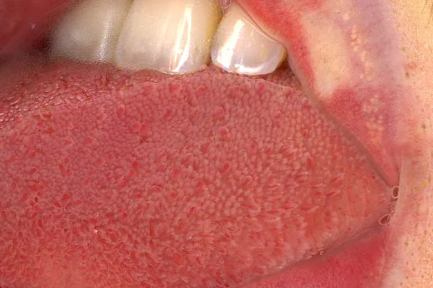 tongue website.jpg