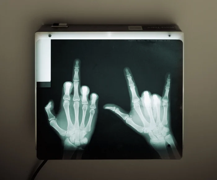 While we're young, found xray 