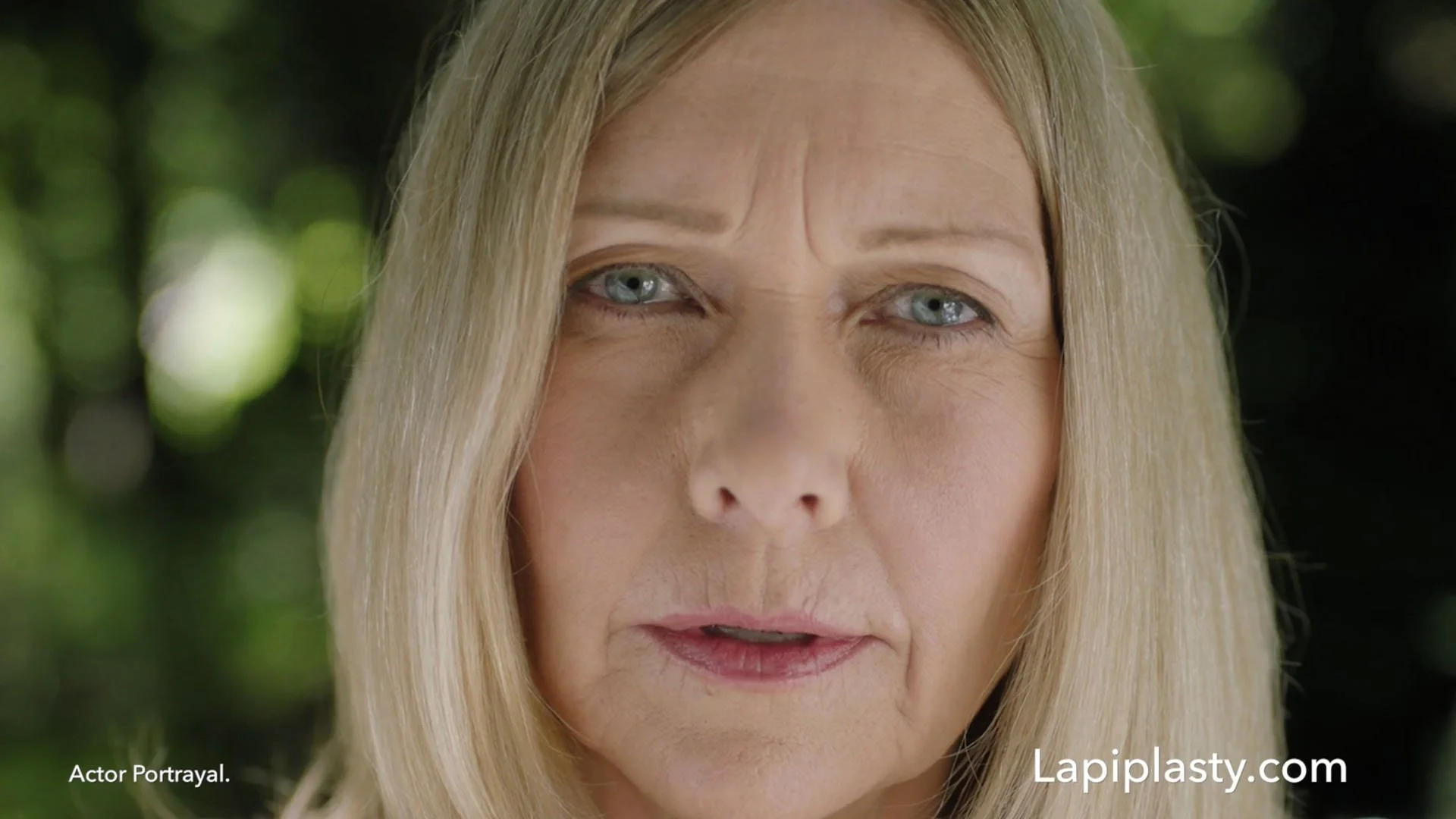 Treace — Outdoor Perspectives 30