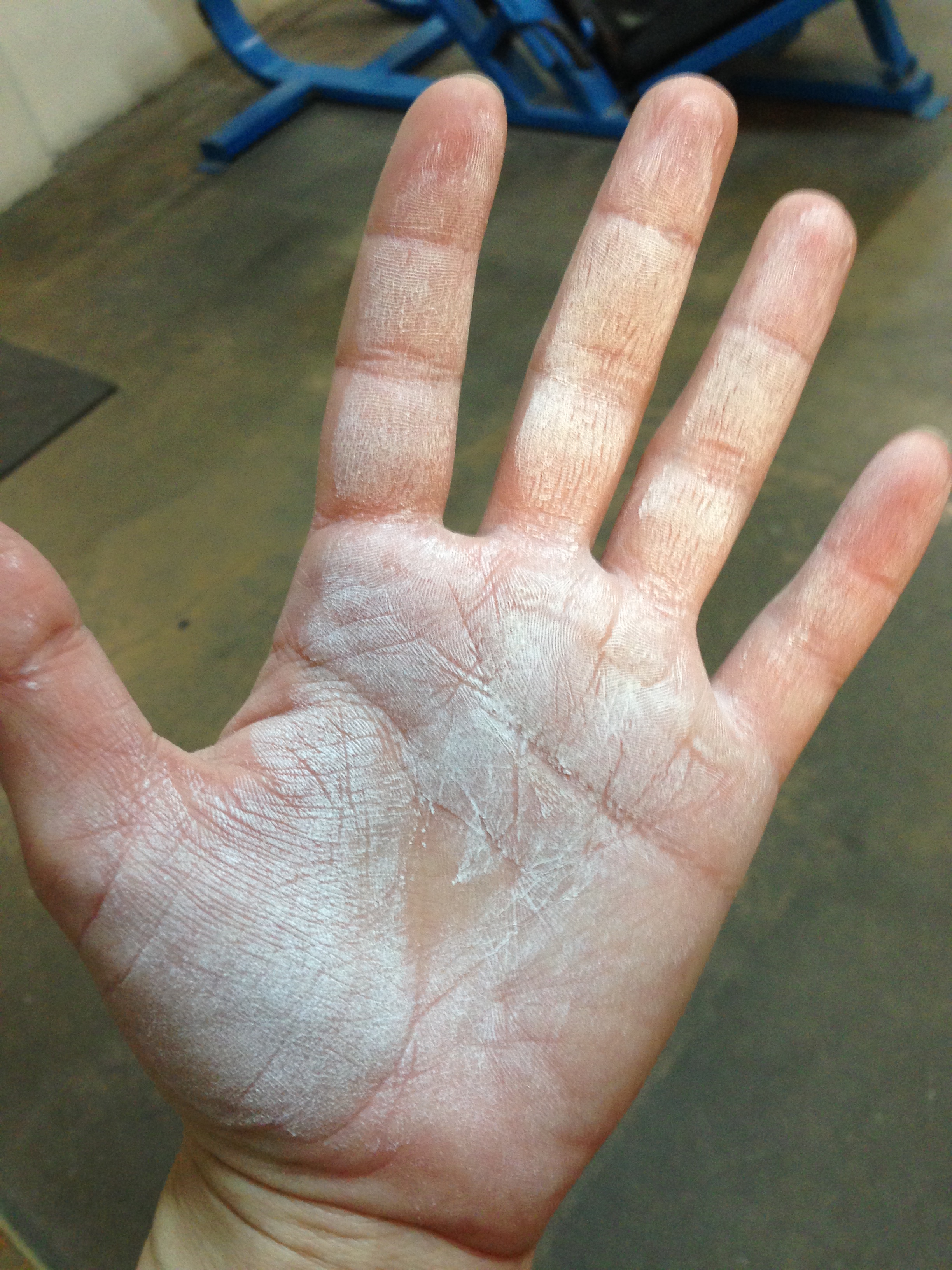 I love my callouses.&nbsp; At least the unchalked area makes a little heart in the middle of my palm.&nbsp; That's feminine, right?