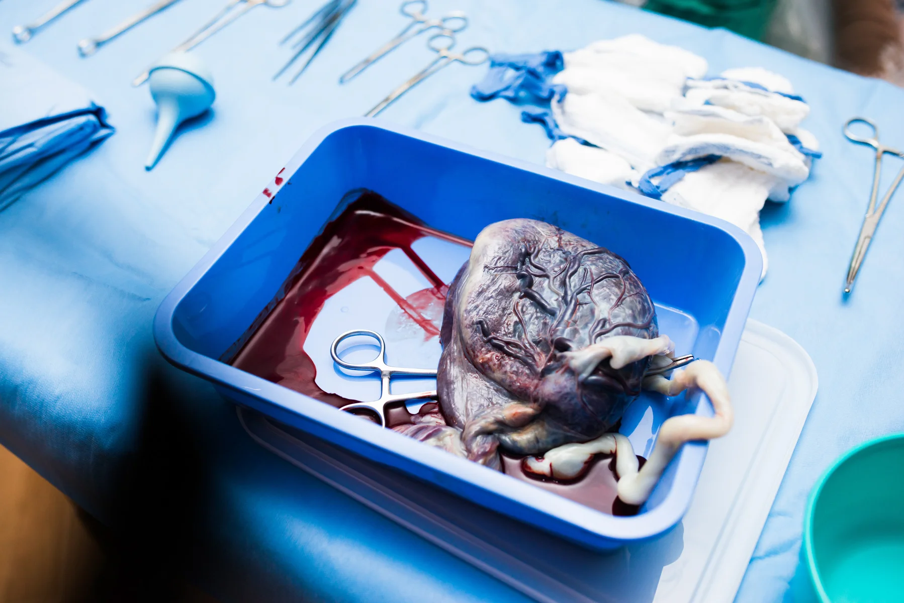 denver-birth-photographer-placenta