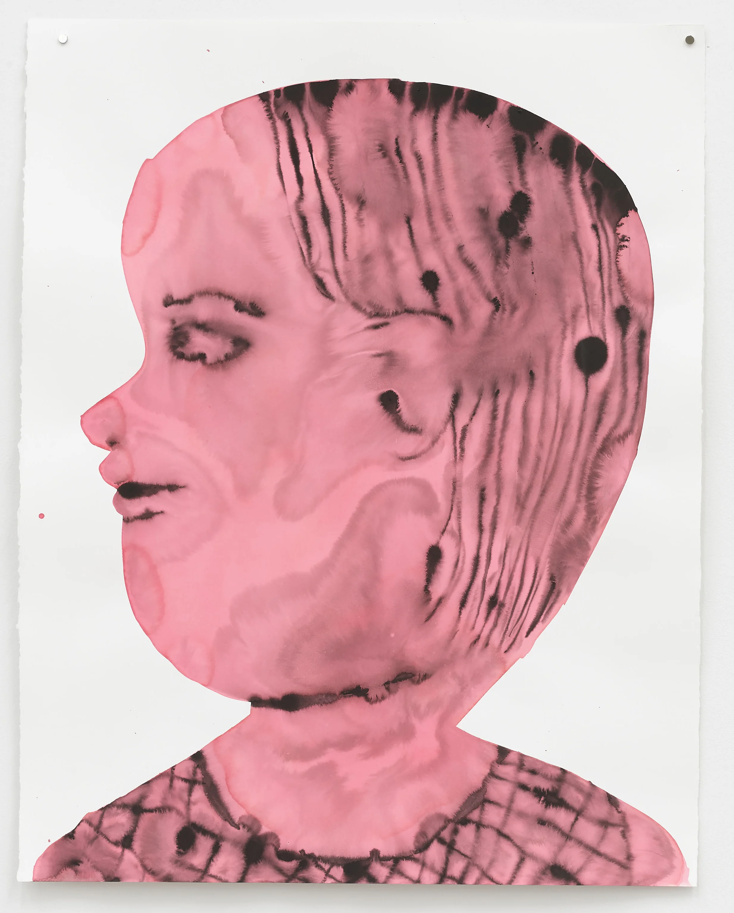 Pink Profile Tennis Elbow Gallery, 2018.jpg