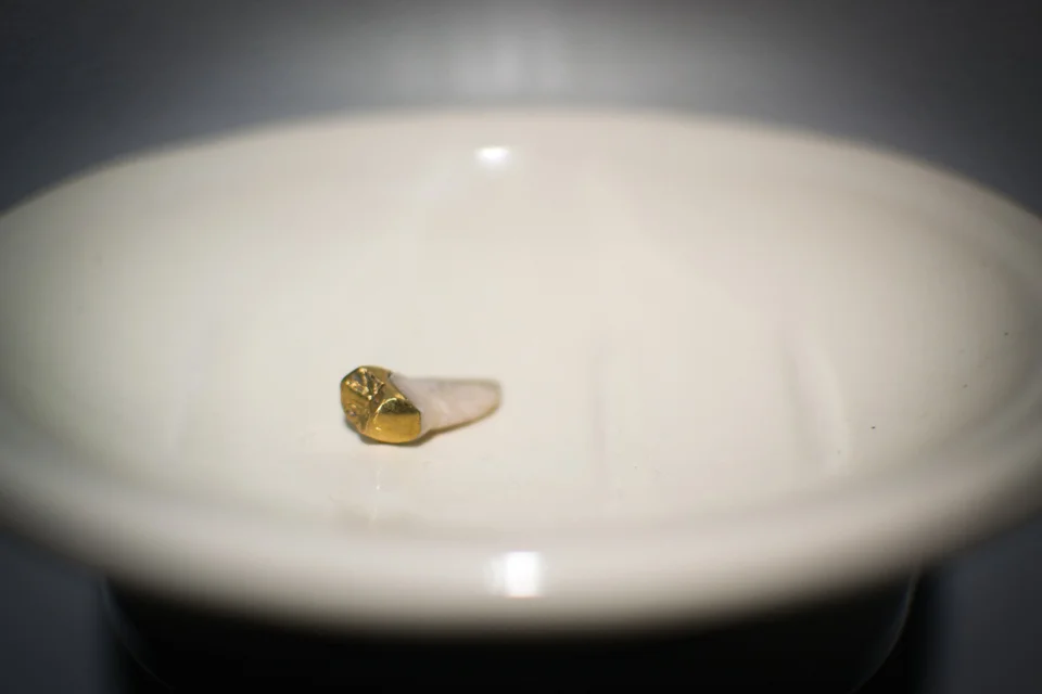 Schaefer_Tooth_2011.jpg