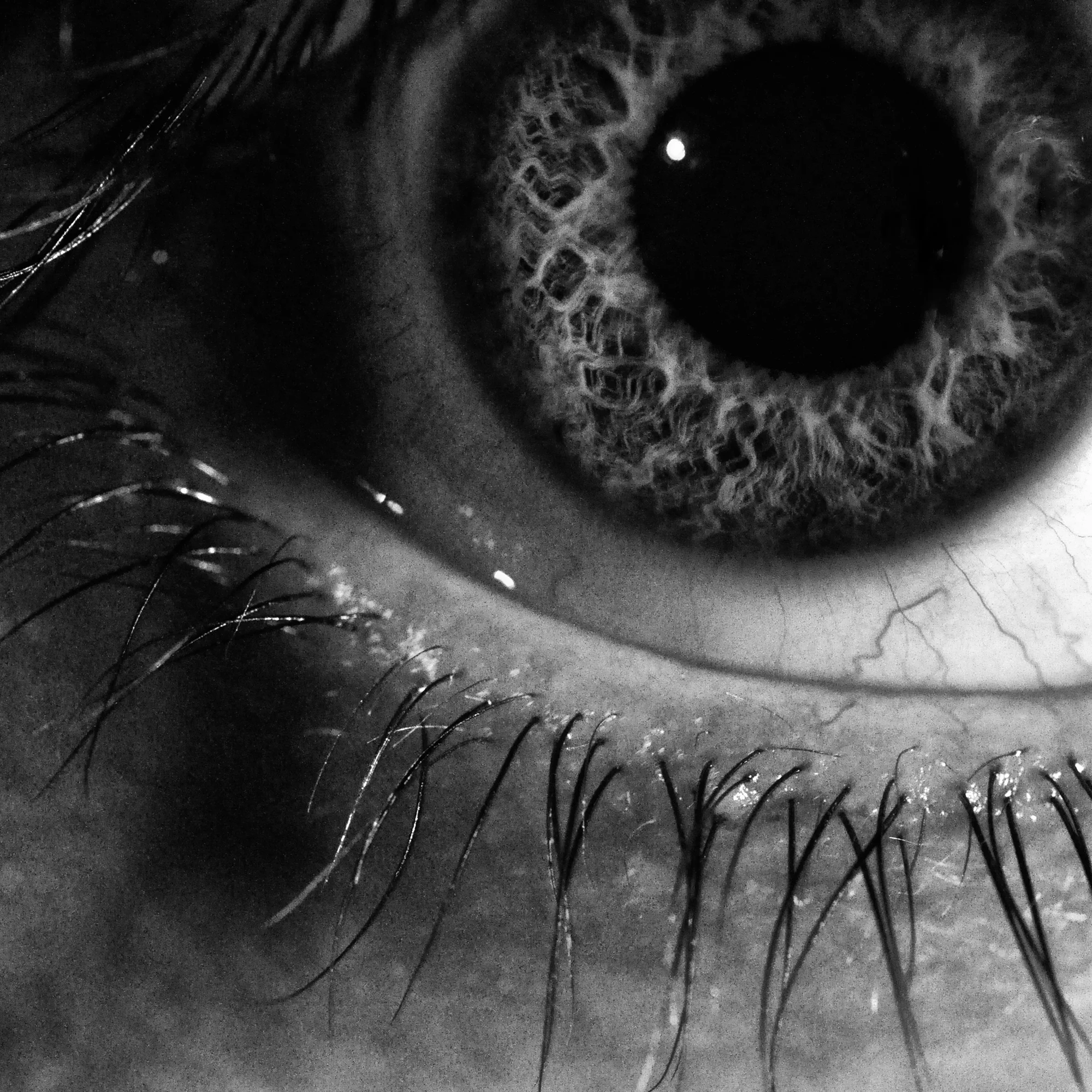 eye.jpg