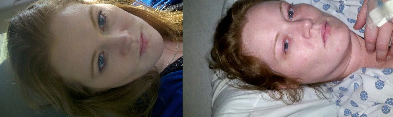 Julie Before GP and After GP.jpg