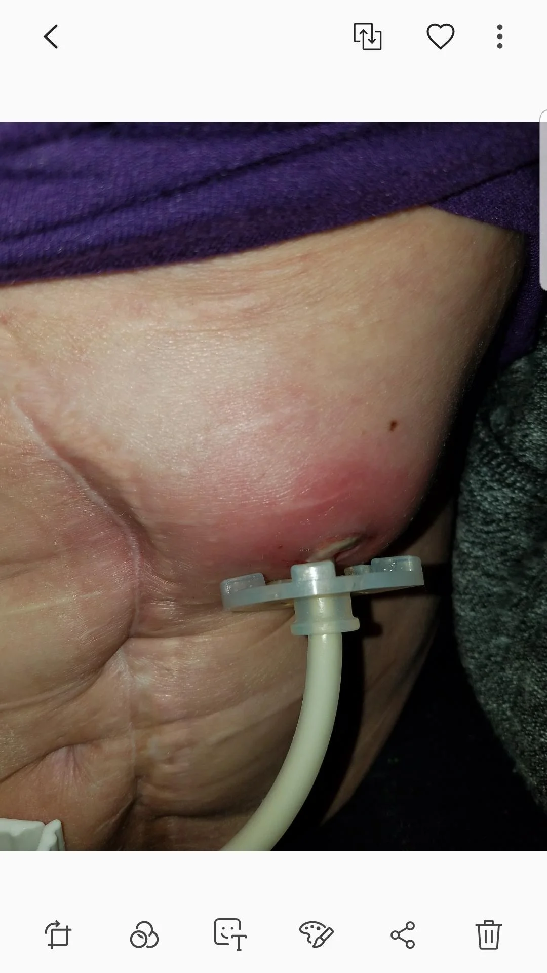 Jodi Zborowski REALLY INFECTED TUBE.jpg