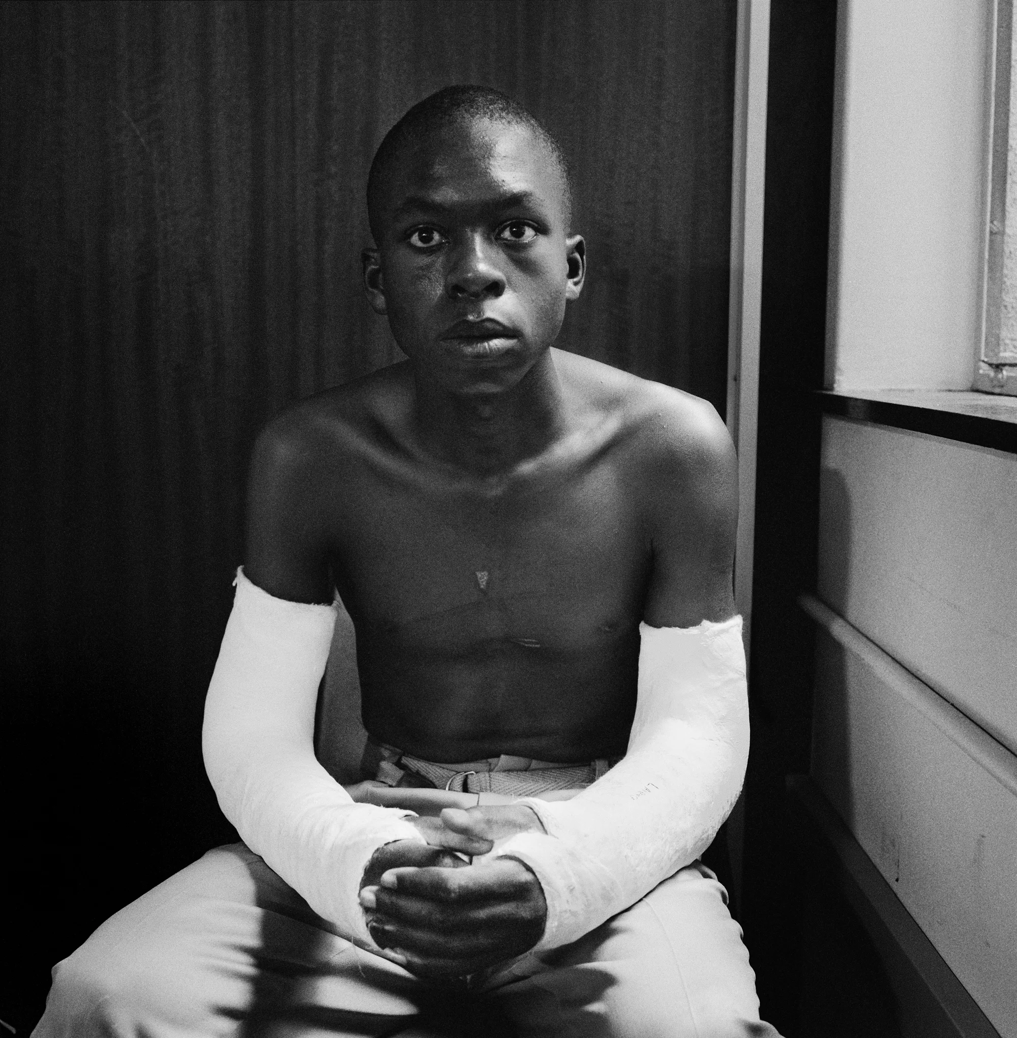 Fifteen-year old Lawrence Matjee after his assault and detention by the Security Police, Khotso House, de Villiers Street, Soweto, Johannesburg, 1985, Gelatin silver print, 38 x 37,5 cm. Courtesy David Goldblatt and Goodman Gallery Johannesburg and Cape Town. © David Goldblatt 