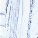 Rhapsody Blue/White