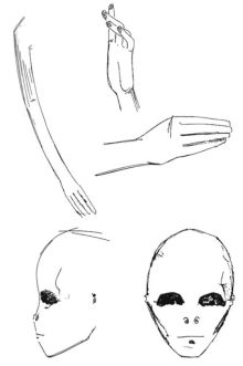 Recreation of Nurse X’s description