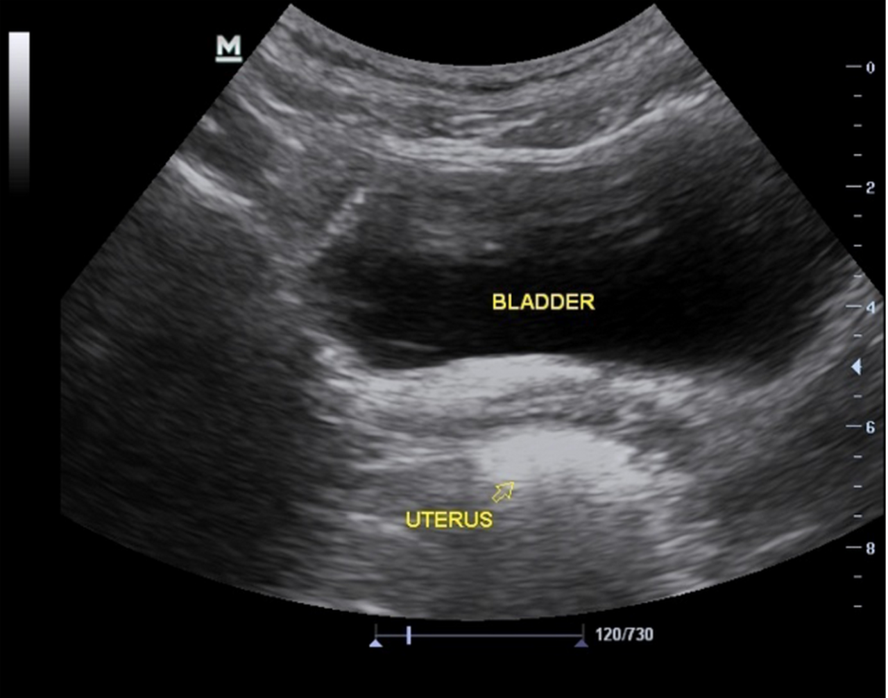 Female Anatomy 