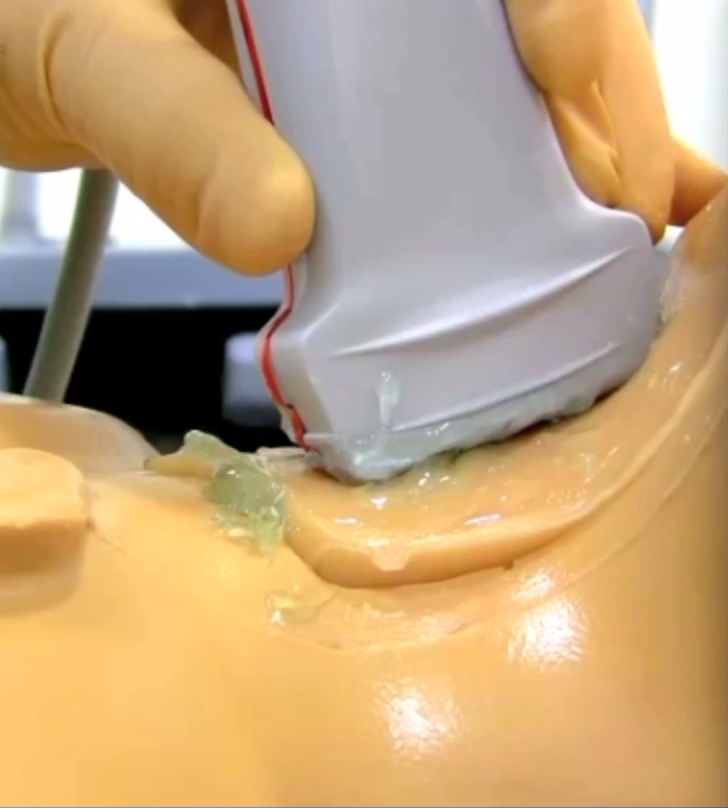 Non-dominant hand holds probe low, using 4th and/or 5th finger for stabilization against patient. From Jason Nomura at Takeokun.com .