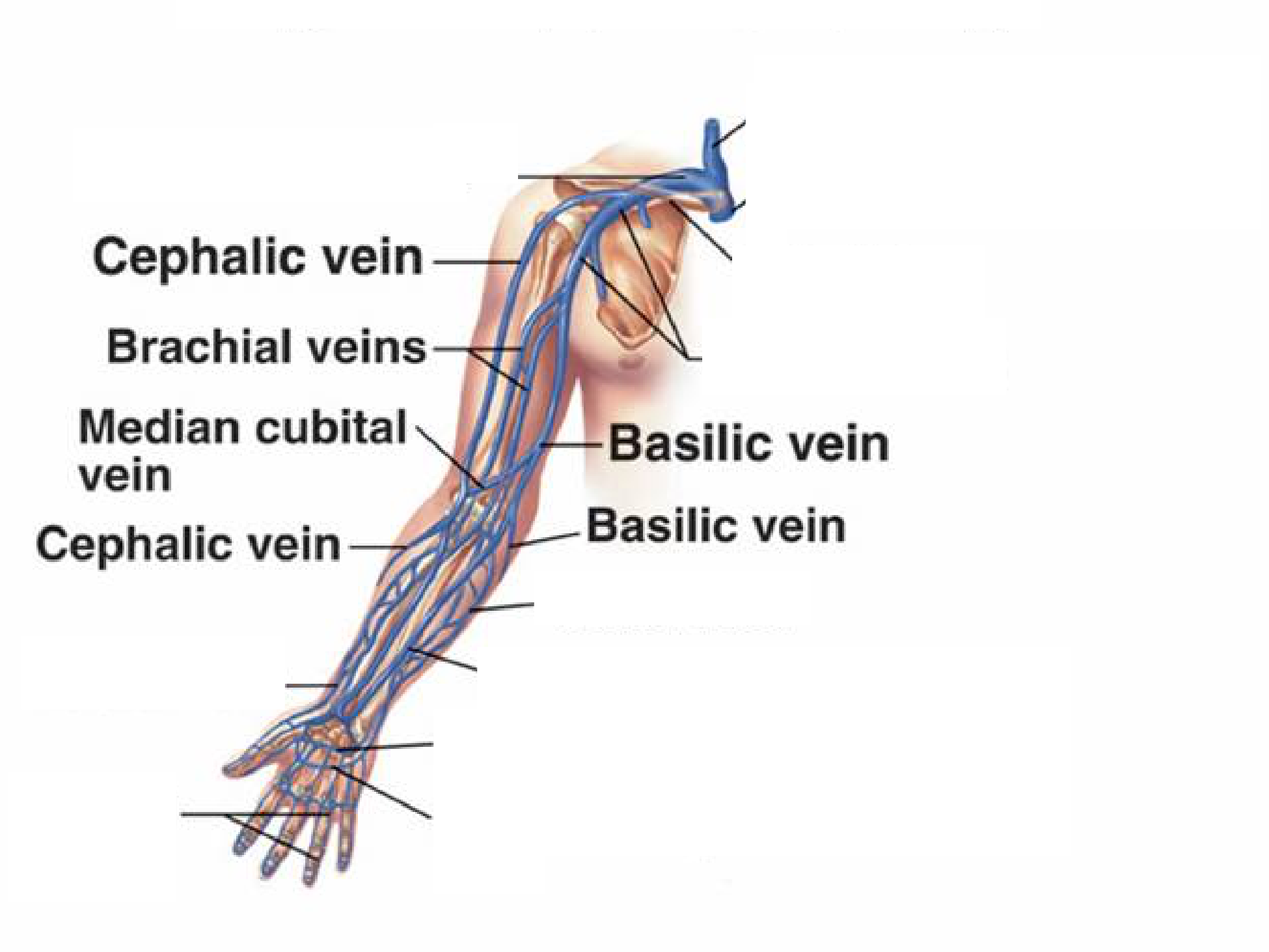 Venous targets for ultrasound guided PIVs. From McGraw Hill Publishing 2006. 