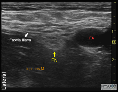 Ultrasound imaging of femoral nerve and surrounding anatomy 
