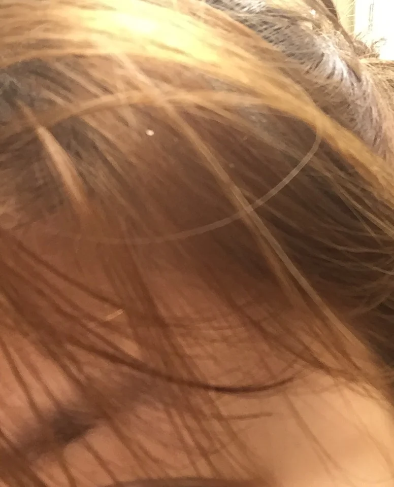 TMI, yes, but here's a speck of dandruff. I'm brutally honest!