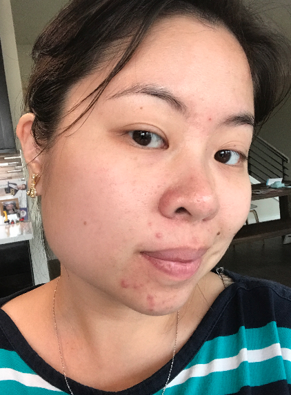 Day 1 of the five step routine with Saranghae #nomakeup #nofilter
