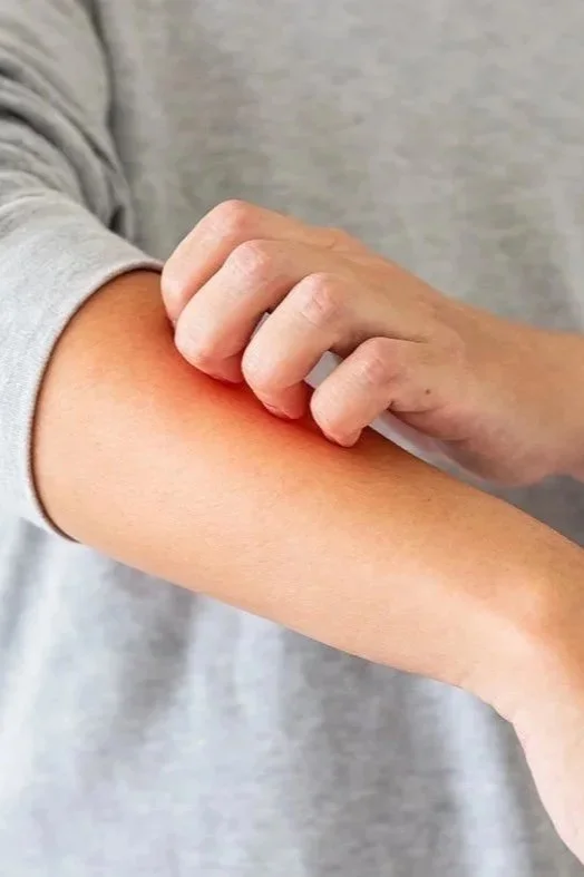 Doktor.com – Psoriasis