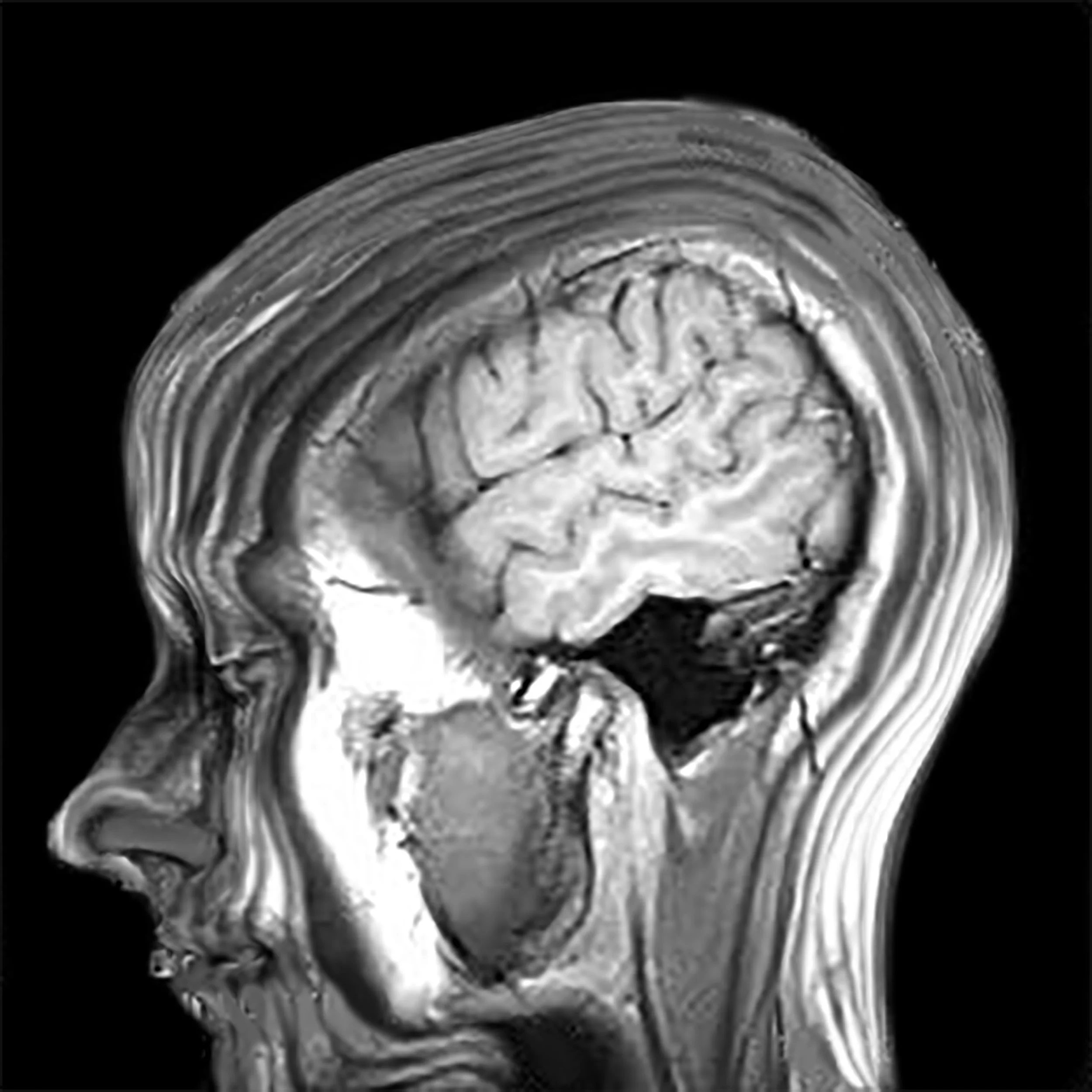 Self-Portrait - MRI