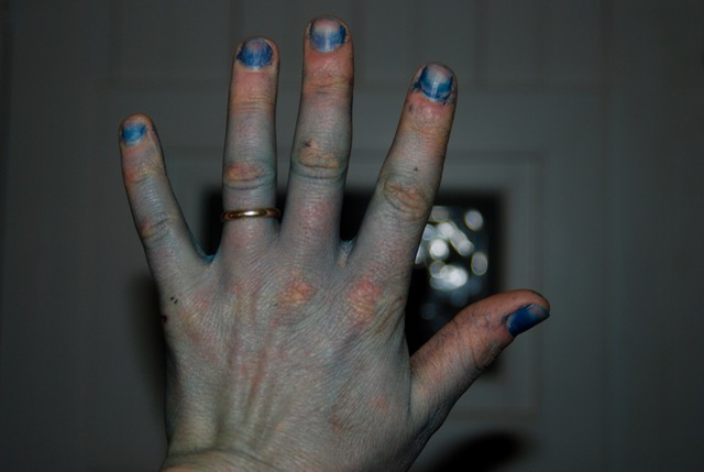 Indigo dyes fingernails especially well.