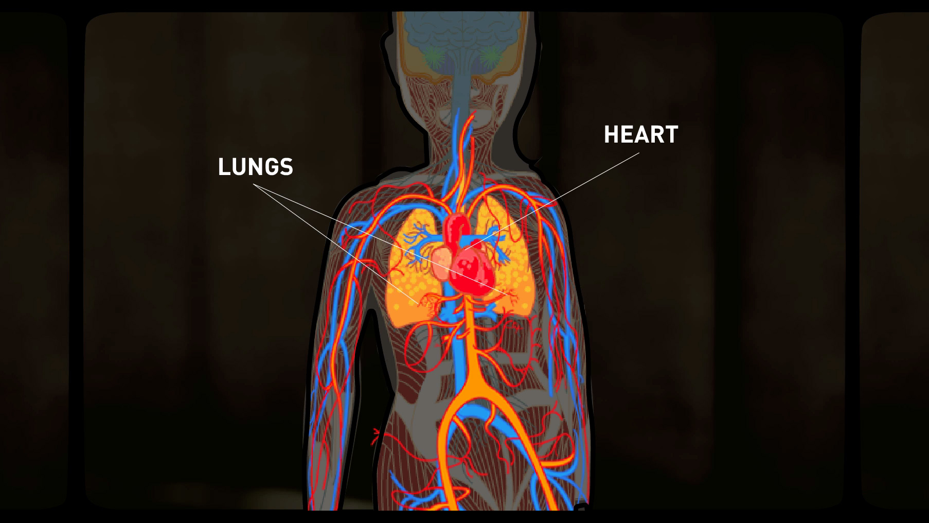 Portfolio-Rheum-Lupus-Anatomy.jpg