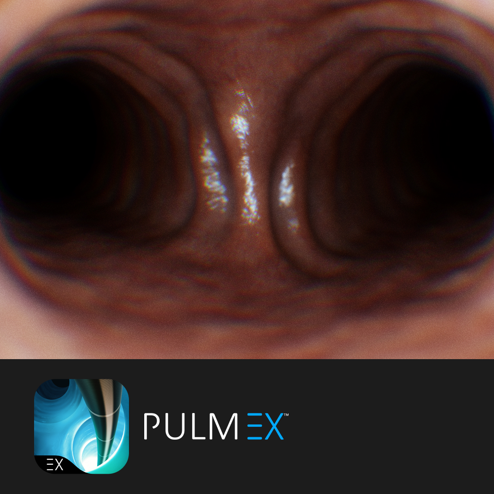 Pulm EX.png