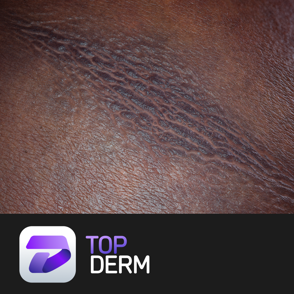 Top Derm.png