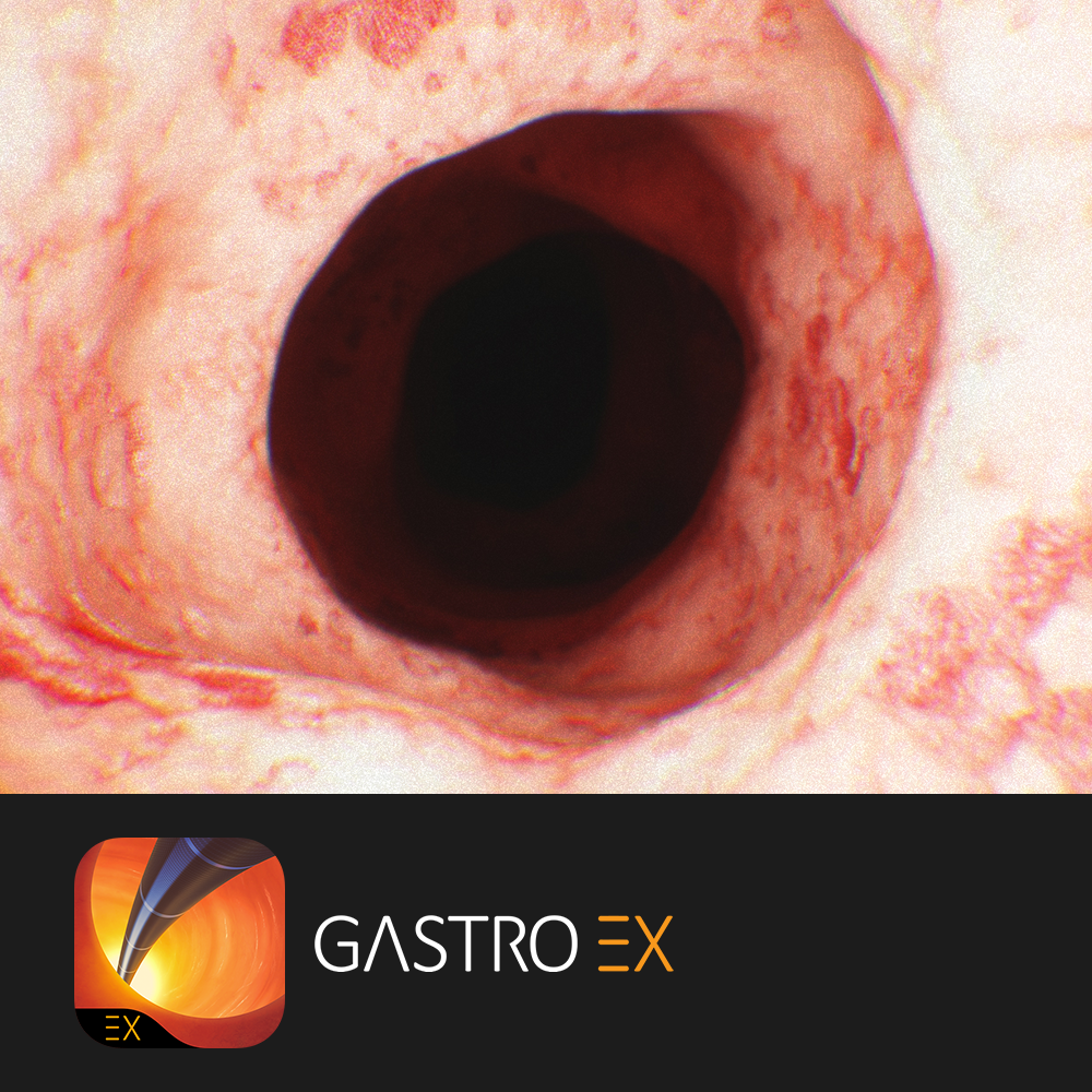 Gastro EX.png