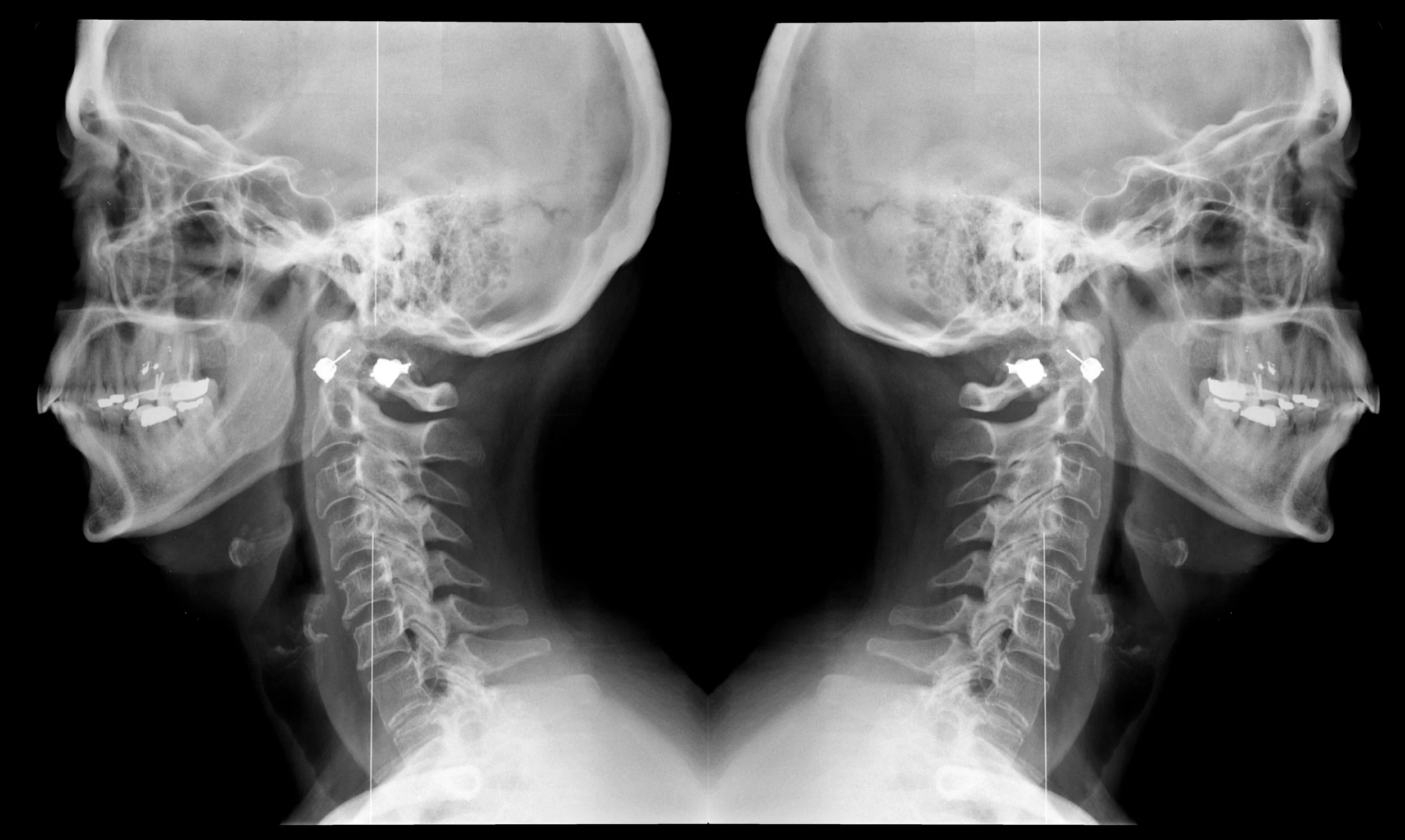 doublehead_xray.jpg