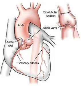 Figure courtesy of www.columbiasurgery.org