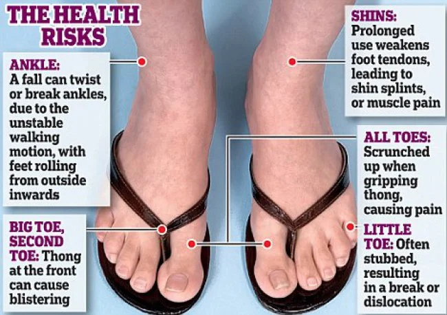 source:http://runhealthylifestyle.com/2016/08/25/careful-flip-flops-dangerous-summer-choice/