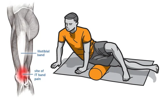 Foam Rolling IT (iliotibial) Band