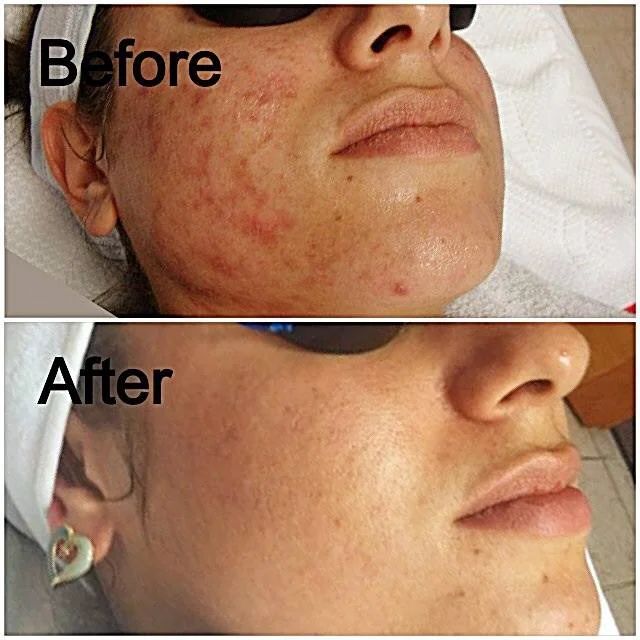 beforeafter.jpg