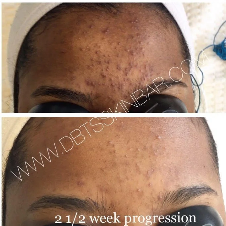 Safiya's Forehead.jpg