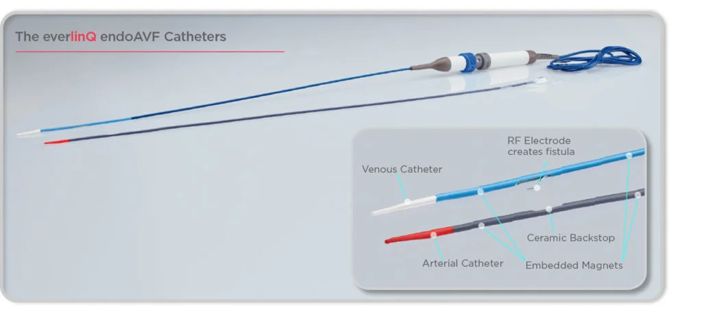 everlinQ endoAVF Catheter (Image from www.tvamedical.com)