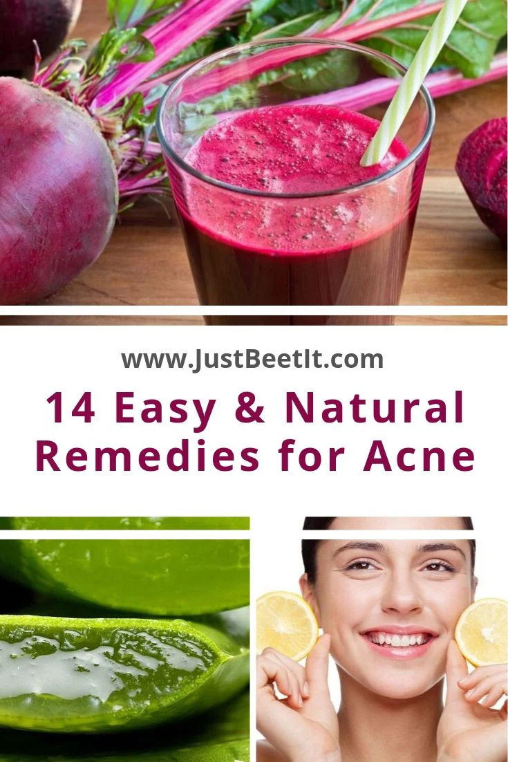 14 Easy and Natural Remedies for Curing Acne and Acne Scars.jpg