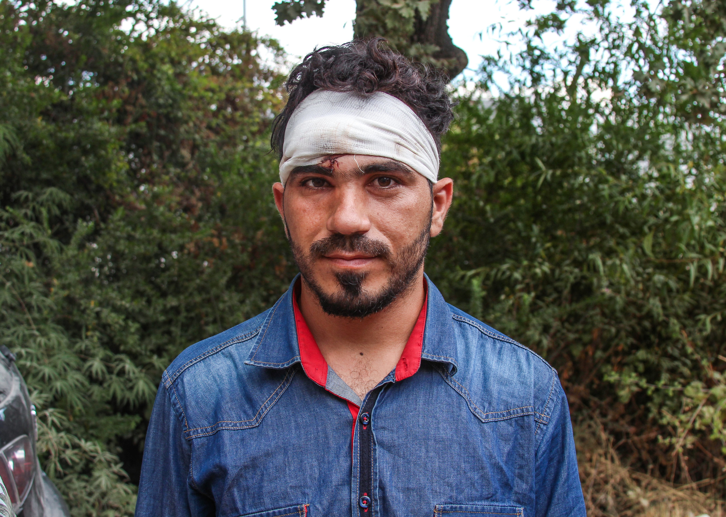  A Syrian migrant sports fresh bandages after allegedly being beaten by Greek police in the Moria Refugee Camp. Countless others were also injured in a riot that destroyed over 60% of the facility. The riots were initiated by refugees due to internal
