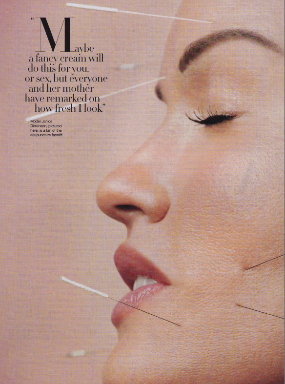 Acupuncture: Can It Make You Look Younger?