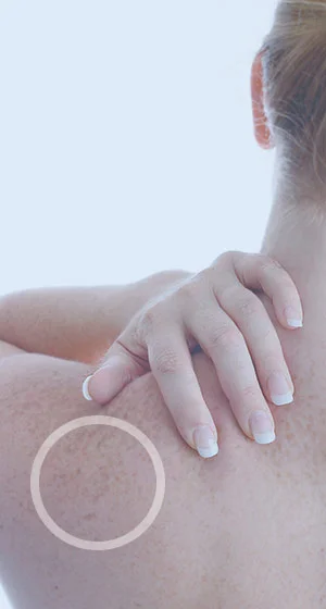 While the effects of photoaging like the freckles pictured here cannot be completely undone, dermatologists can apply topical treatments and services to improve skin health.