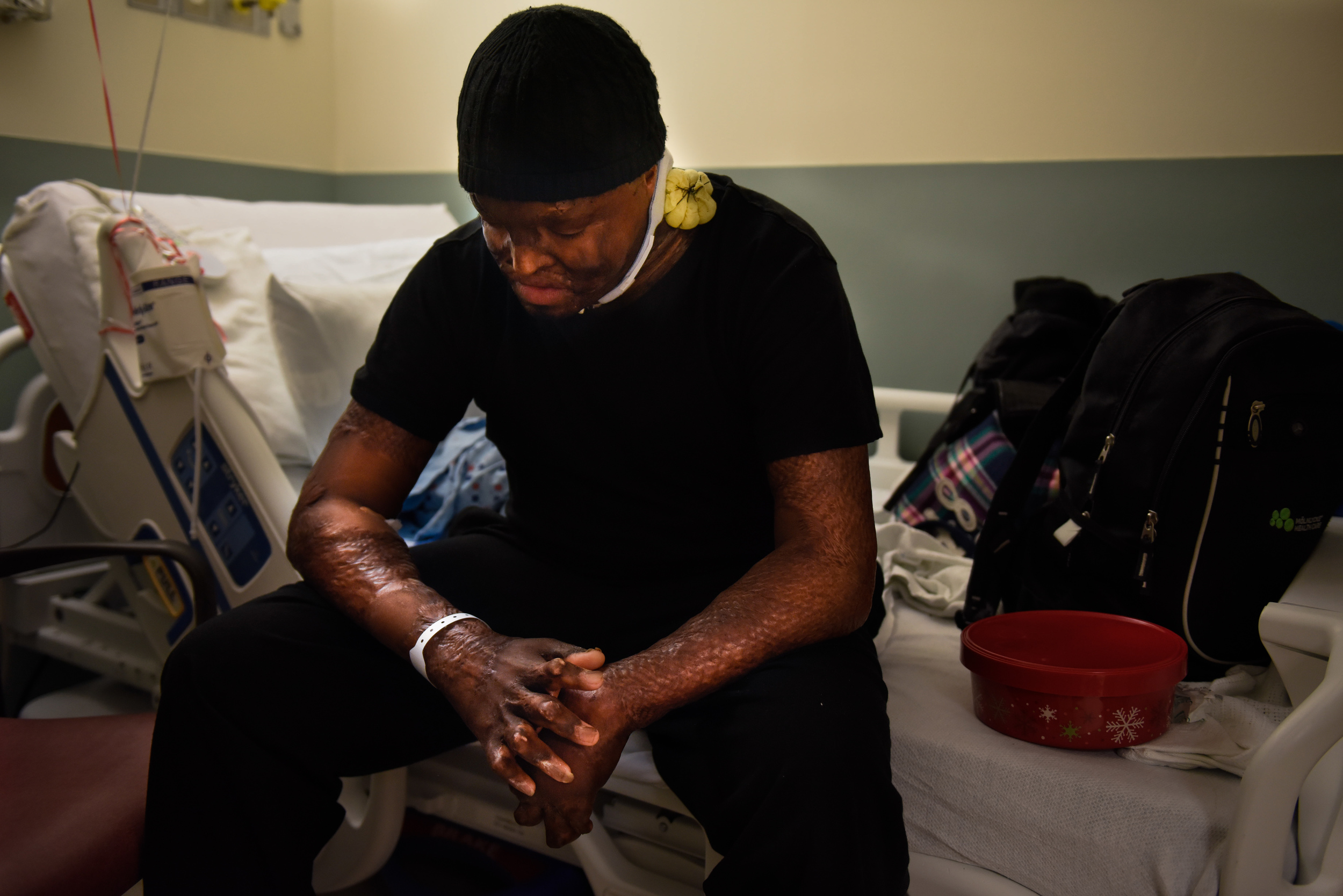 Shaheem Hall (25) takes a quiet moment to himself at Monroe Hospital Rochester, NY after one of many surgeries he has been through in his lifetime. Shaheem was burned in a house fire when he was eight years old and is still in the recovery proc