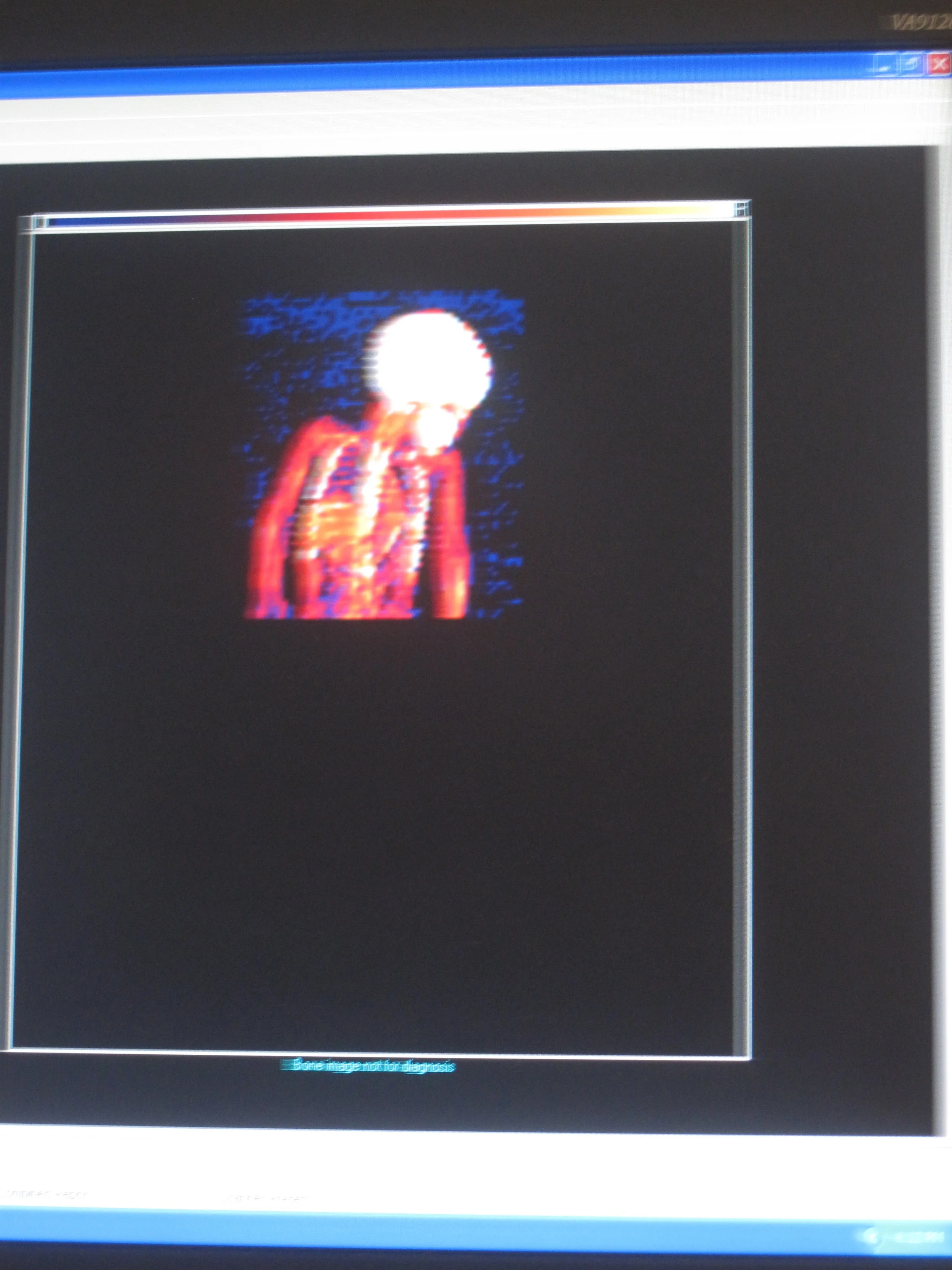 Brooke's DEXA scan in progress...