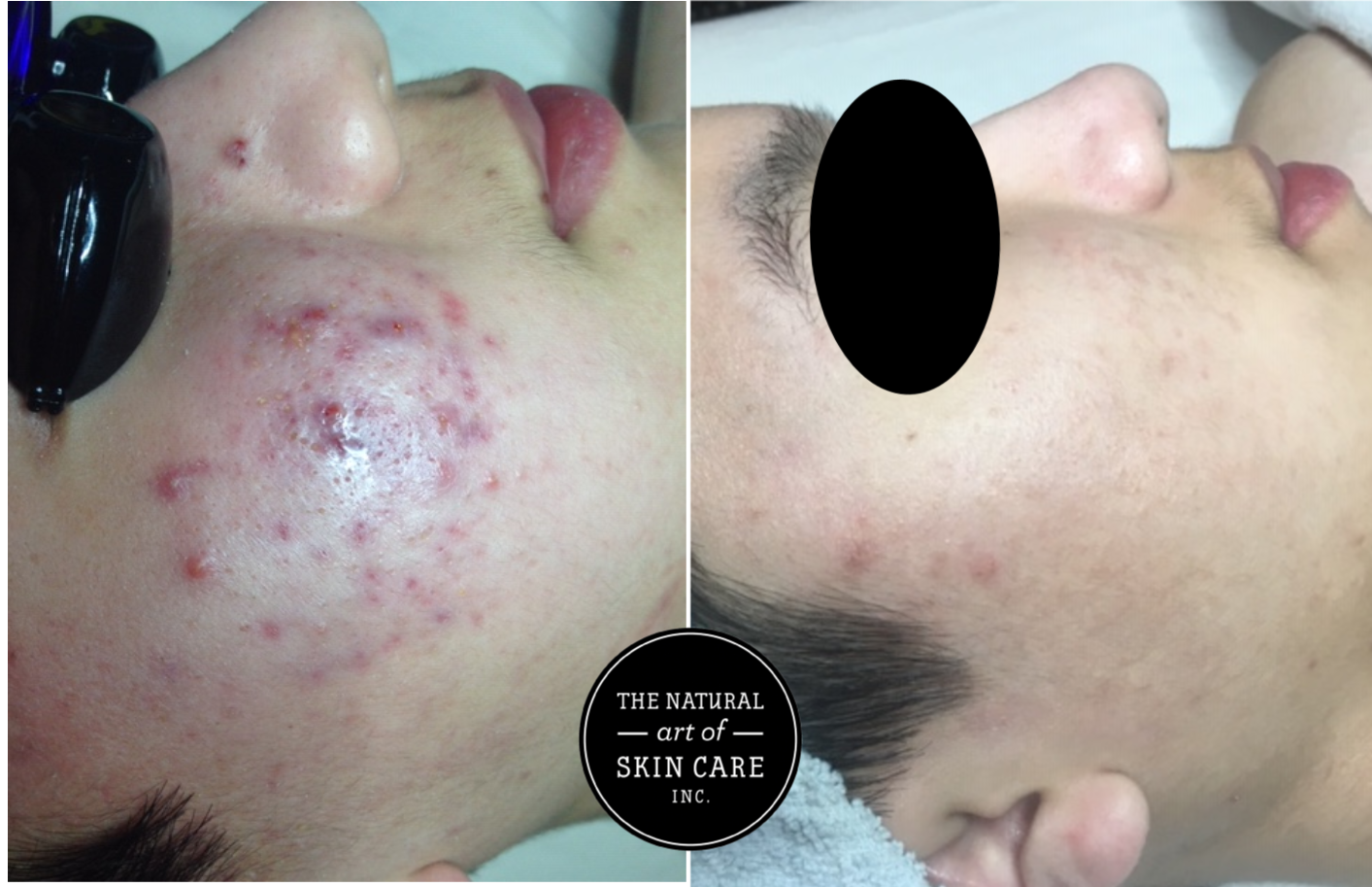 Same client…new face! Before (left) and After (Right)