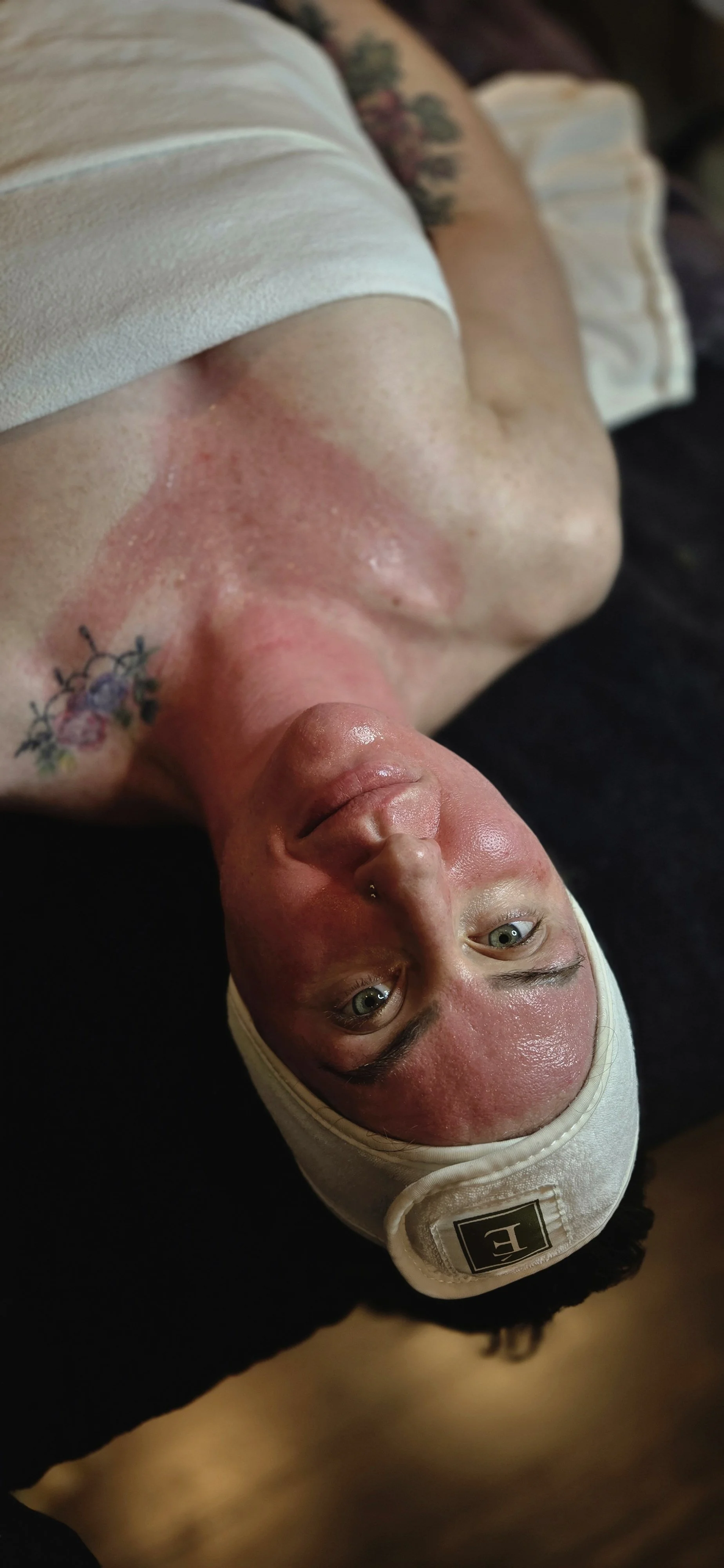 YOUR GUIDE TO MICRO-NEEDLING TREATMENTS