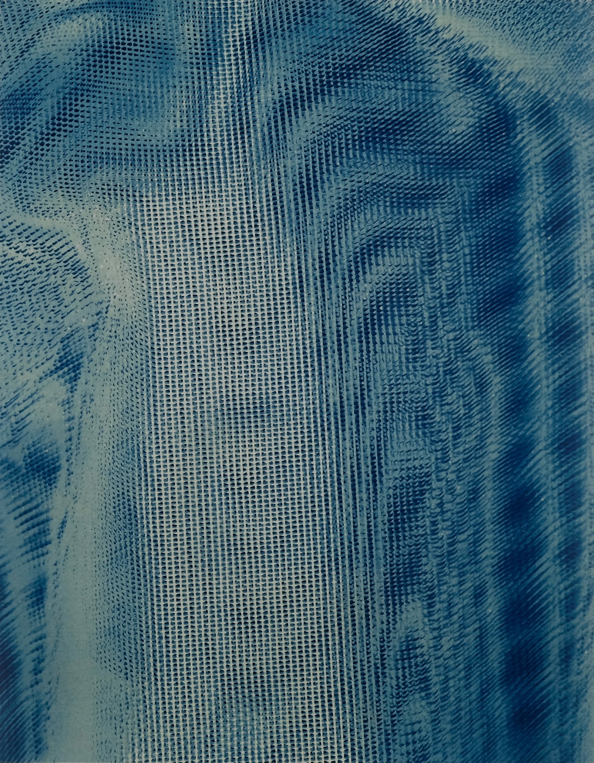 Cataract