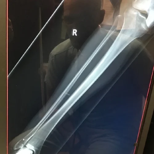 xray.jpg