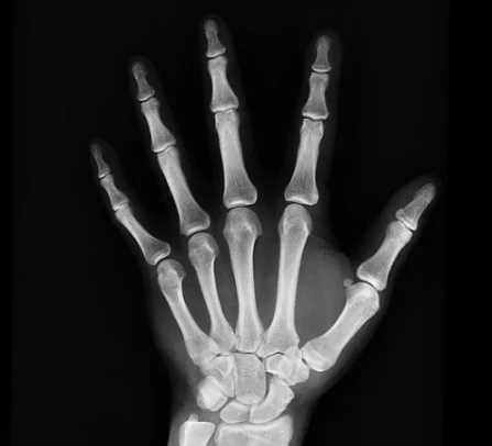 x-ray-1704855_640.jpg