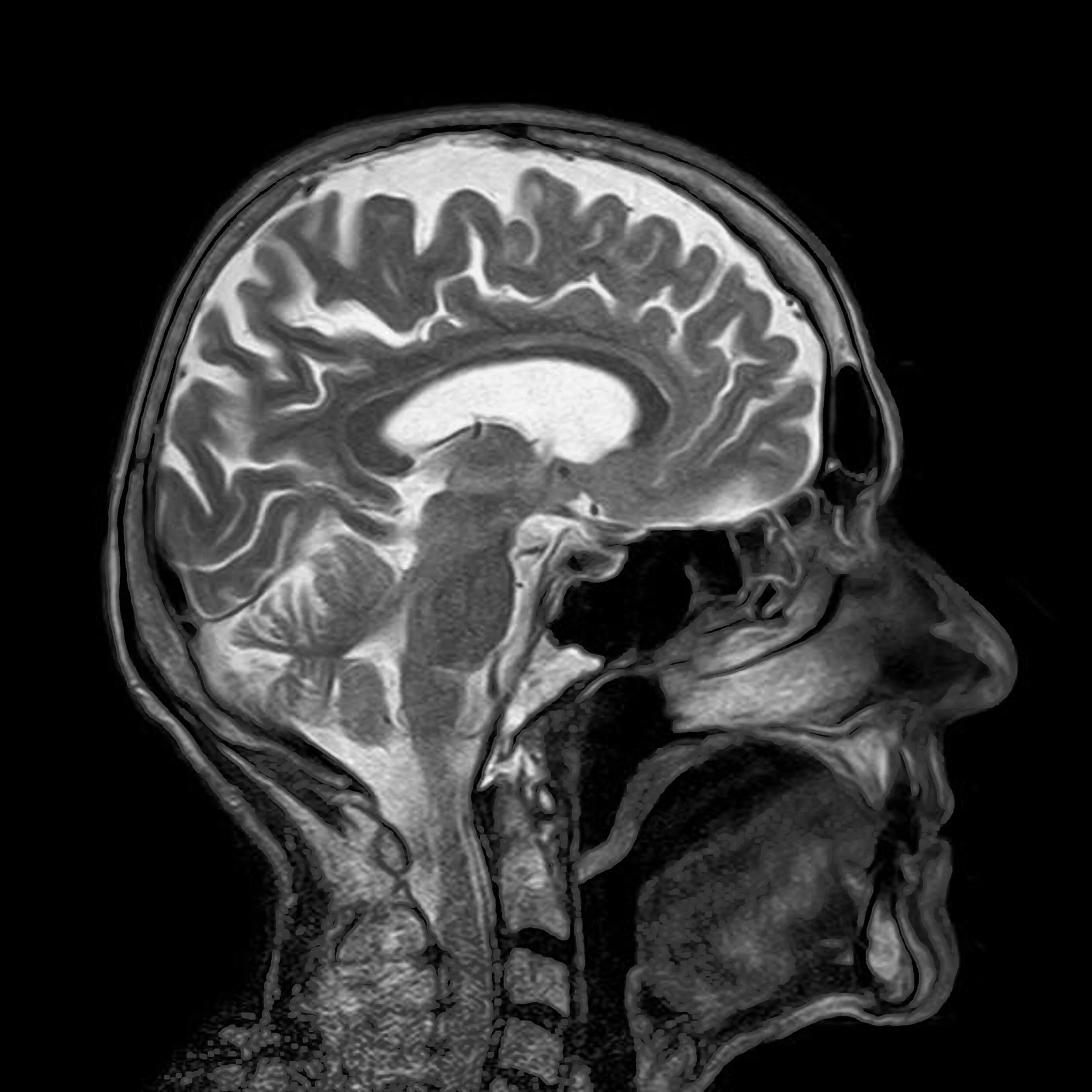 MRI right side.jpg