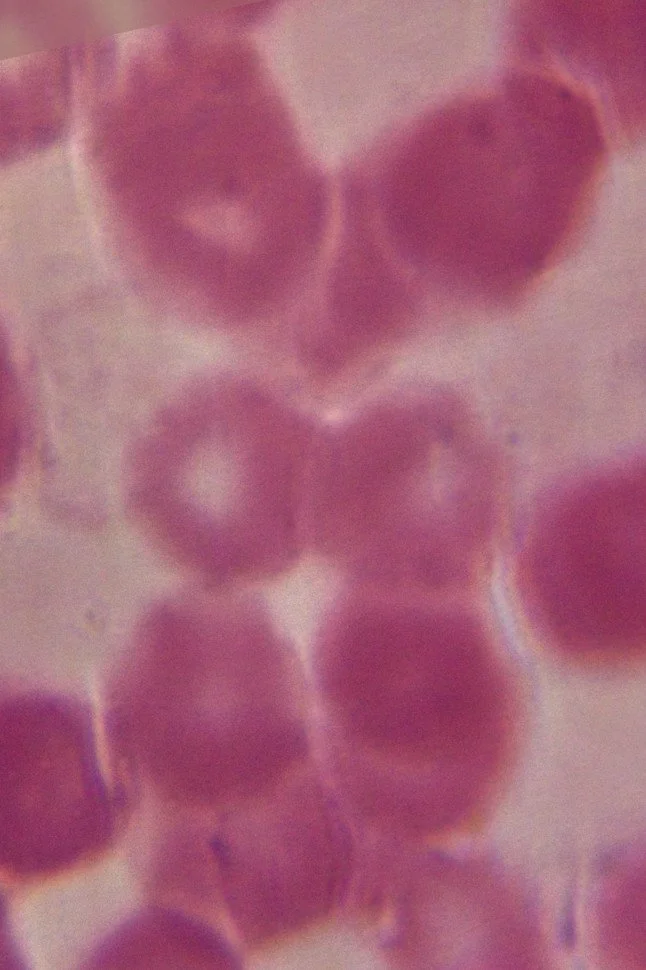 Human Blood Smear no66 cell split.jpg